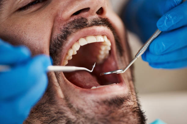 Best 24-Hour Emergency Dental Care in Ivanhoe, TX